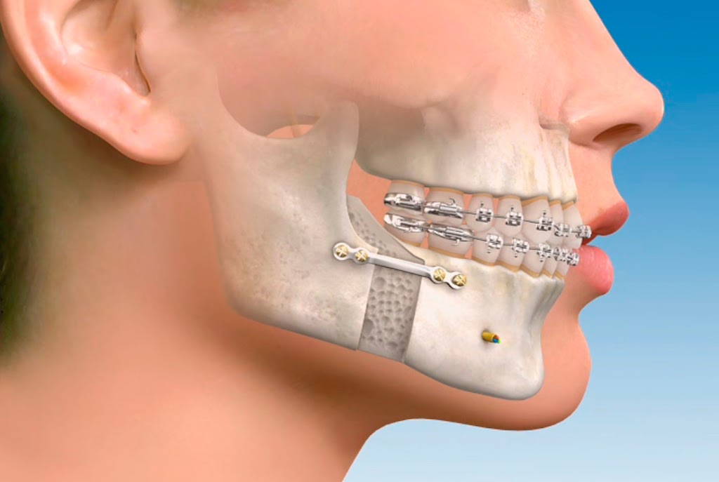 Cirugía Maxilofacial Cedoi